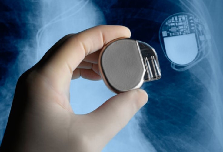  Picture of Heart Pacemaker